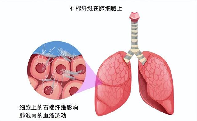 1Kg含百万根“钢针”！被66国禁用的石棉，为何在我国随处可见？,1Kg含百万根“钢针”！被66国禁用的石棉，为何在我国随处可见？,第8张