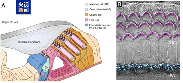 有望为听障患者带来福音！我国科学家又有新发现→